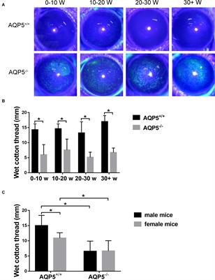 Expression Profiles of CircRNA and mRNA in Lacrimal Glands of AQP5–/– Mice With Primary Dry Eye